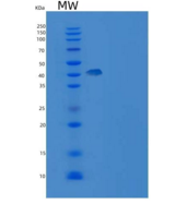 人SETD7 / SET7/9重组蛋白His tag