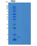 小鼠TALLA-1 / TSPAN7重组蛋白His tag