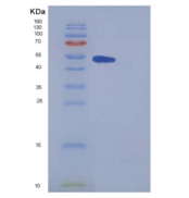 小鼠METAP2 / MAP2重组蛋白His tag