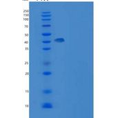 人SETD7 / SET7/9重组蛋白His tag