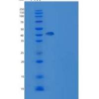 人SETD7 / SET7/9重组蛋白His tag