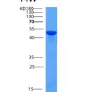 小鼠SerpinB12重组蛋白His tag
