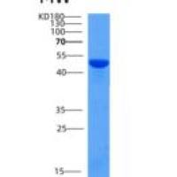 小鼠SerpinB12重组蛋白His tag