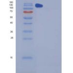 小鼠CHL-1重组蛋白Fc tag