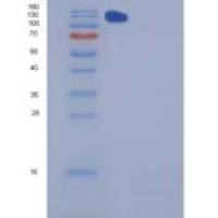小鼠CHL-1重组蛋白Fc tag