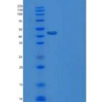 小鼠VDR / NR1I1重组蛋白His tag