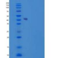 人SOCS3 / CIS3重组蛋白His & Trx tag