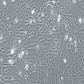 人晶状体上皮细胞 HLE-B3