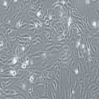 人晶状体上皮细胞 HLE-B3