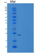 人DIM1 / TXNL4A重组蛋白His tag