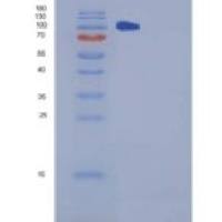 小鼠CHL-1重组蛋白