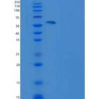 大鼠KIM-1 / TIM1 / HACVR1重组蛋白His & Fc tag