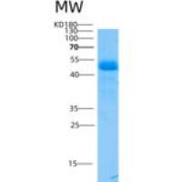 小鼠ASM3A / SMPDL3A重组蛋白His Tag