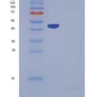 小鼠Serpinb6b重组蛋白His tag