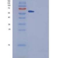 人SPG21重组蛋白GST tag