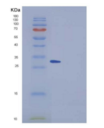 小鼠SPARCL1 / SPARC-like 1重组蛋白Hi