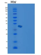 小鼠HPGD / 15-PGDH重组蛋白His tag