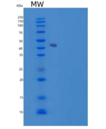 小鼠软骨凝集蛋白(CHODL)重组蛋白Fc tag