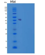 人SOCS3 / CIS3重组蛋白His & Trx tag