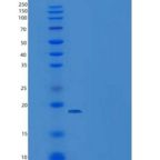 人DIM1 / TXNL4A重组蛋白His tag