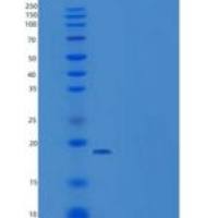 人DIM1 / TXNL4A重组蛋白His tag