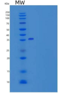 人ORP150 / HYOU1 / HSP12A重组蛋白Hi