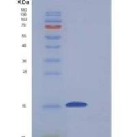 小鼠CD7分子(CD7)重组蛋白His tag