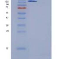 人A2M/cpam D5/α-2-巨球蛋白重组蛋白His tag