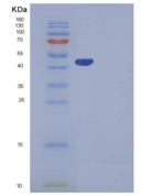 小鼠Serpinb6b重组蛋白His tag