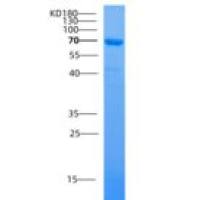 人ATL1 / SPG3A / Atlastin-1重组蛋白GST tag