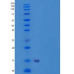人骨成型蛋白受体2(BMPR2)重组蛋白His Tag