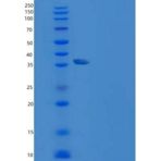 大鼠CD155 / PVR / NECL5重组蛋白His tag