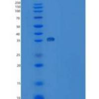 人周期素依赖性激酶2(CDK2)重组蛋白His Tag