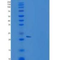 人CLEC4A / CLECSF6 / DCIR重组蛋白His tag