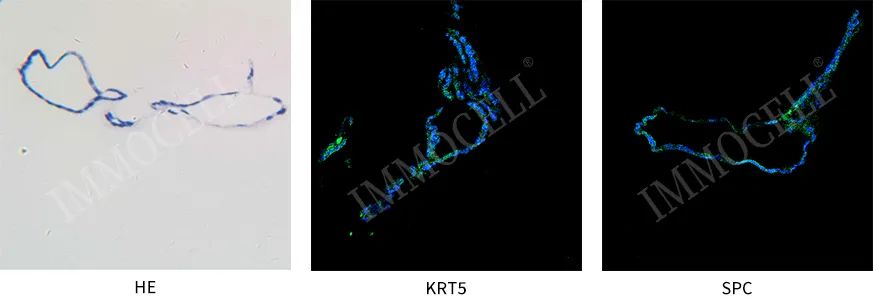 逸漠生物iPSC诱导肺类器官产品