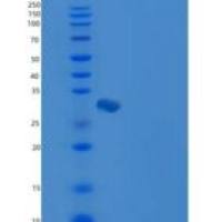 小鼠HPGD / 15-PGDH重组蛋白His tag