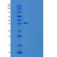 人AKR1B1重组蛋白His tag