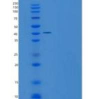 人NCR3 / NKp300重组蛋白His & Fc tag