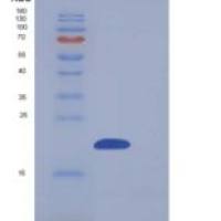 人NUDT2 / Ap4A hydrolase重组蛋白His tag