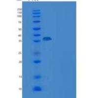 小鼠CD3d / CD3重组蛋白Fc tag