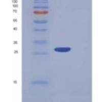 人血小板因子4V1(PF4V1)重组蛋白Fc Tag