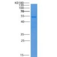 人脂多糖结合蛋白(LBP)重组蛋白His Tag