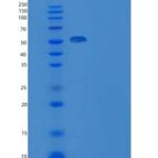 小鼠Art4 / CD297重组蛋白Fc tag