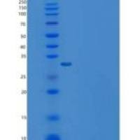 小鼠Carbonic Anhydrase X / Car10重组蛋白His tag