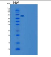人DUSP14 / MKP-6重组蛋白His & MBP t