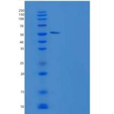 人酪氨酸羟化酶(TH)重组蛋白His tag