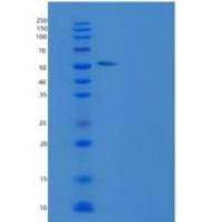 人酪氨酸羟化酶(TH)重组蛋白His tag