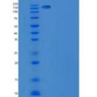 人ITGA8 & ITGB1 Heterodimer重组蛋白