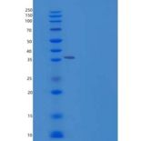 小鼠RCN3重组蛋白His Tag