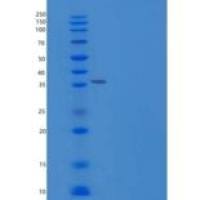 小鼠RCN3重组蛋白His Tag